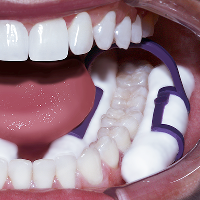 Isolator®+in+use+pic