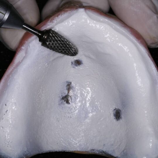 Pic_Hydent_StepByStep_3