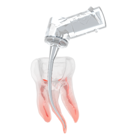 PD_IrriFlex_Image_3DTooth-1000x1000